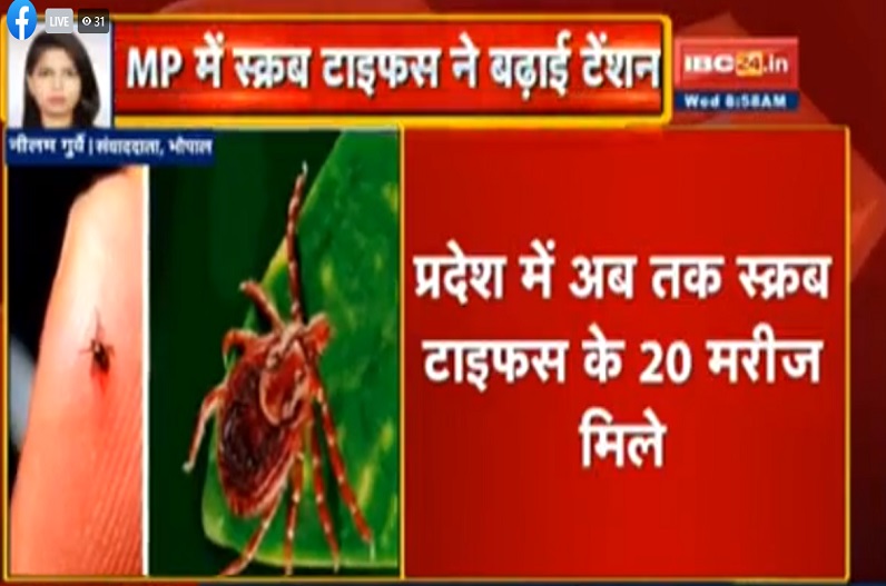 स्क्रब टाइफस ने बढ़ाई चिंता, प्रदेश के इन जिलों में मिले 20 केस, दो मरीज निकले पोस्ट कोविड