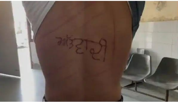 हिंदुस्तान में तालिबानी सजा! कैदी की पीठ पर लोहे की रॉड से लिखा ‘आतंकवादी’, जेल अधीक्षक पर बड़ा आरोप