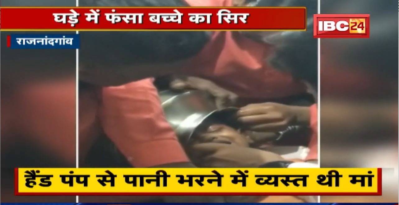बच्चे का सिर स्टील के घड़े में फंसा | Doctor ने ऐसे बचाई जान | देखिए