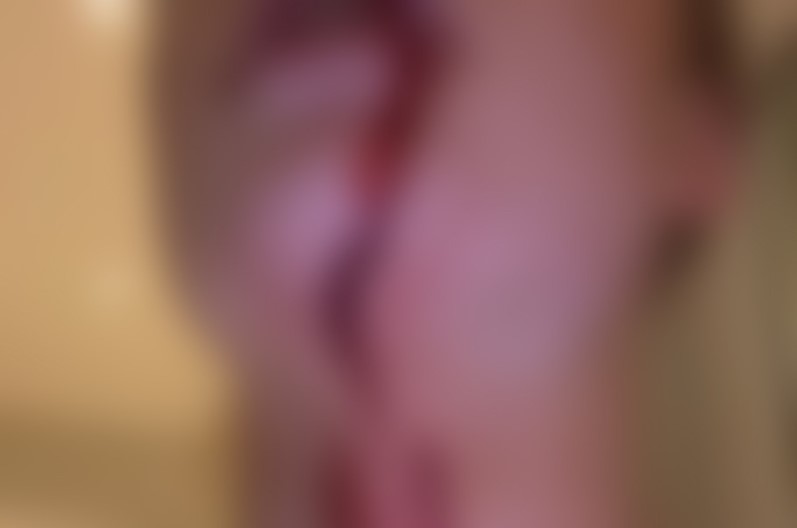 नामी खिलाड़ी पर पूर्व प्रेमिका ने लगाया मारपीट का आरोप, सोशल मीडिया पर शेयर की खून से लथपथ तस्वीरें