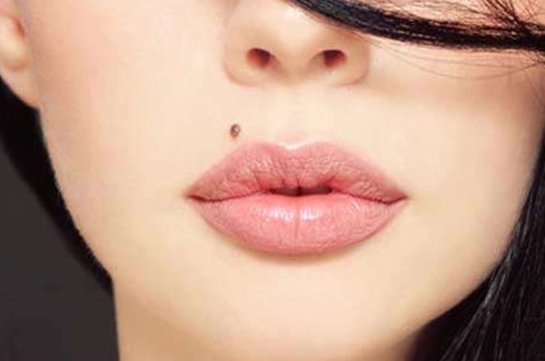 how to get rid of dry lips