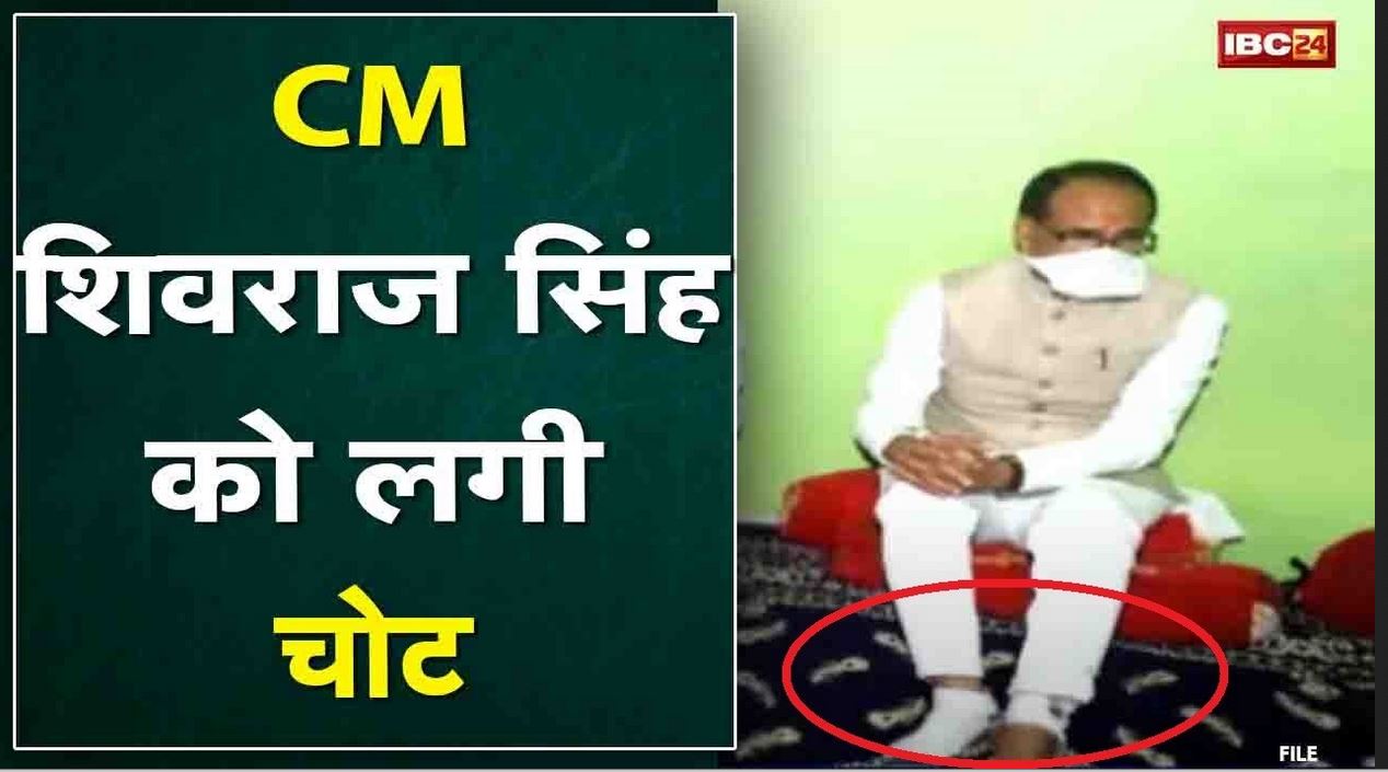 CM Shivraj Singh Chouhan को लगी चोट | सीहोर में बूथ विस्तारक अभियान के दौरान पैर में लगी चोट