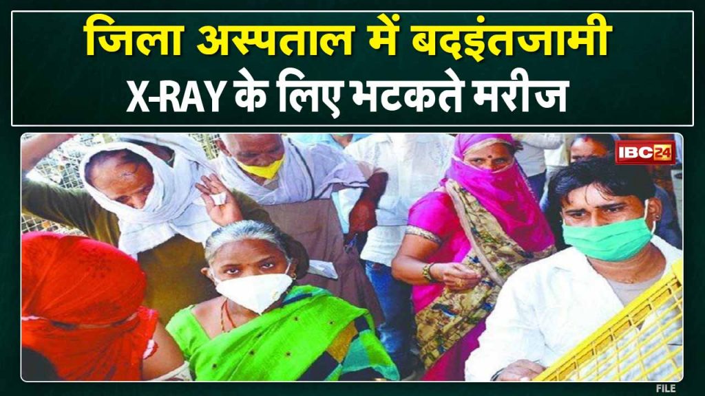 Mismanagement in Jabalpur District Hospital | Not only X-Ray Film for 8 months. See