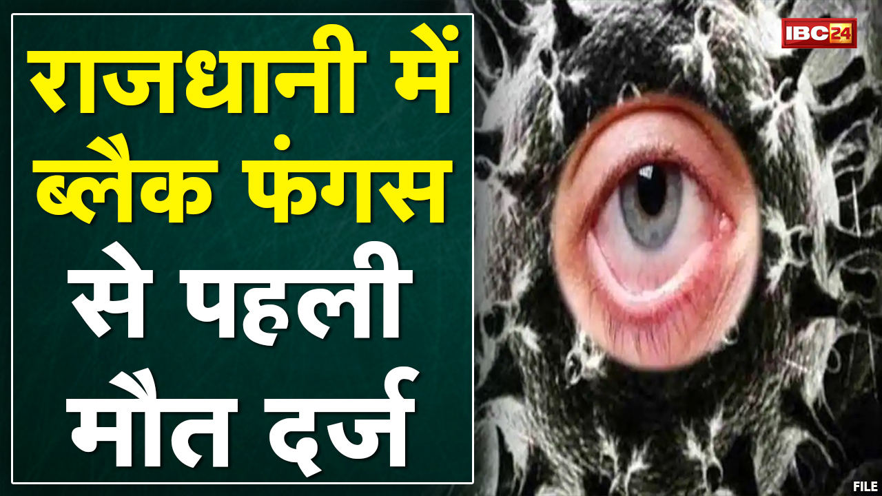 Bhopal : Black Fungus से महिला की मौत | मौत के बाद केस स्टडी के निर्देश