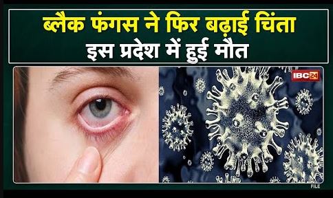 Black Fungus in Bhopal : कोरोना की तीसरी लहर में ब्लैक फंगस से पहली मौत | 5 दिन से चल रहा था इलाज