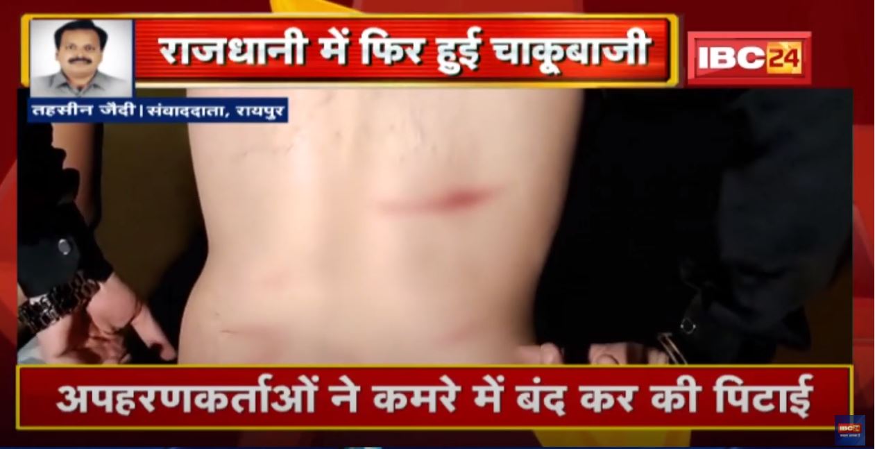 Raipur Crime News : राजेंद्रनगर में फिर हुई चाकूबाजी | चाकू के हमले में दो युवा कारोबारी घायल