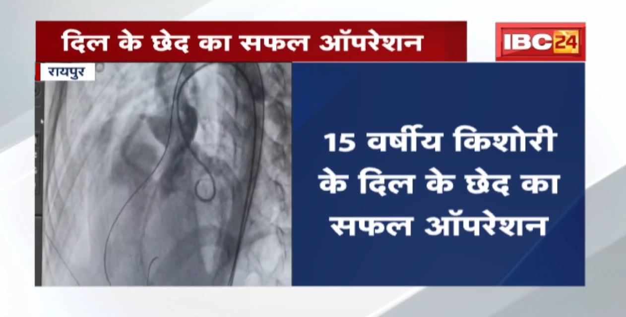 Raipur : दिल के छेद का सफल Operation | Dr. Bhim Rao Ambedkar Hospital में हुआ सफल ऑपरेशन