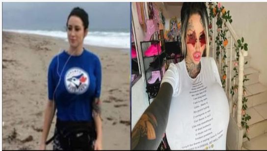 बदसूरत दिखने के लिए मॉडल ने कई बार कराई सर्जरी, खर्च किये 75 लाख रुपये, बेडौल हो गया सुडौल शरीर