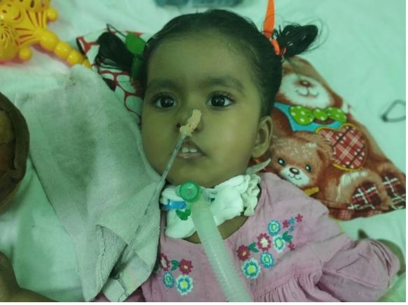 सृष्टि को लगा 16 करोड़ का जोलजेस्मा इंजेक्शन, गंभीर बीमारी से ग्रसित है 24 महीने की बच्ची, SECL की मदद से हुआ संभव