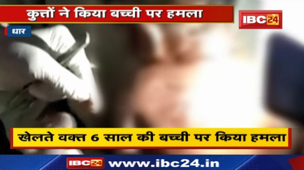 Dhar News : 6 year old girl playing away from home was bitten by dogs. deep wounds on head and body