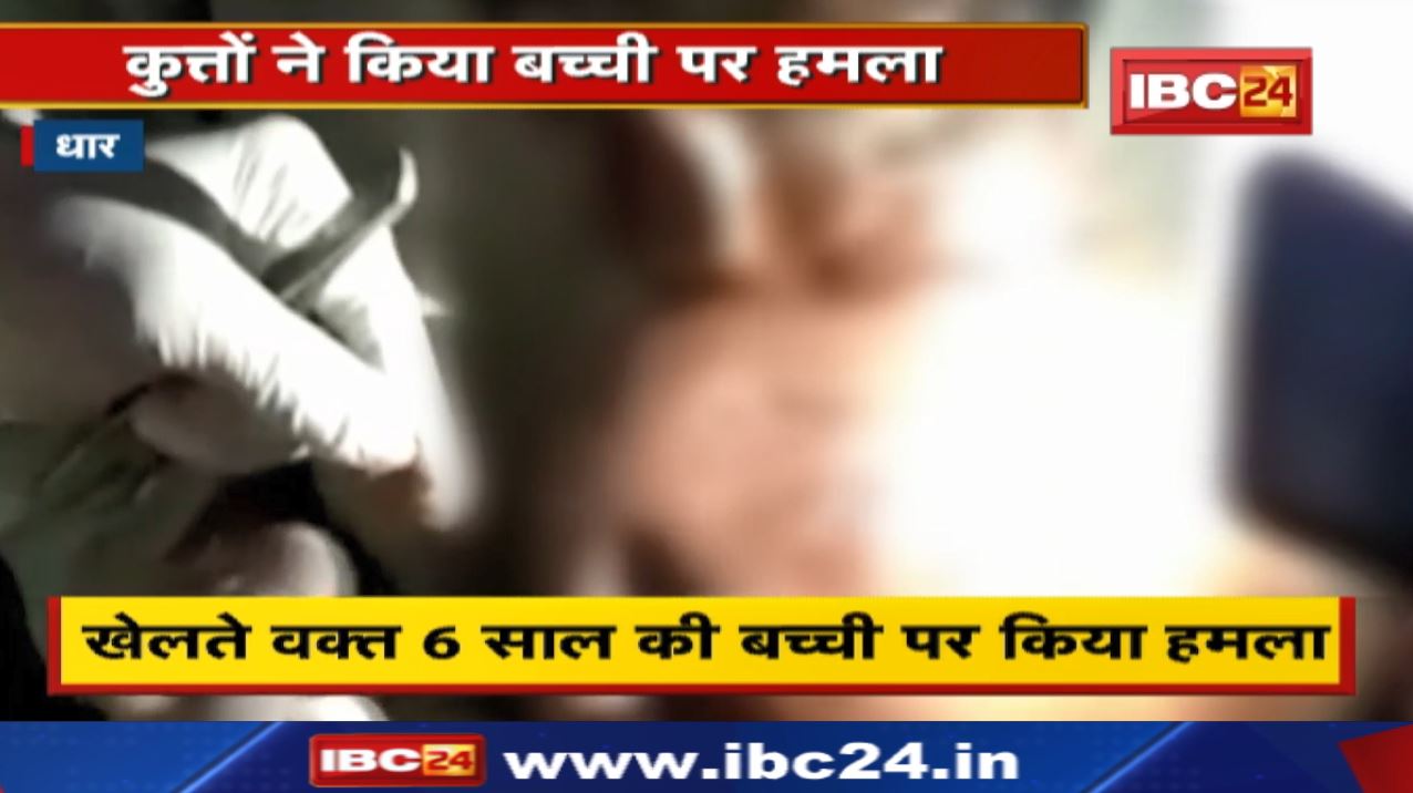 Dhar News : घर से दूर खेल रही 6 साल की बच्ची को कुत्तों ने नोंचा | सिर और शरीर में गहरे घाव