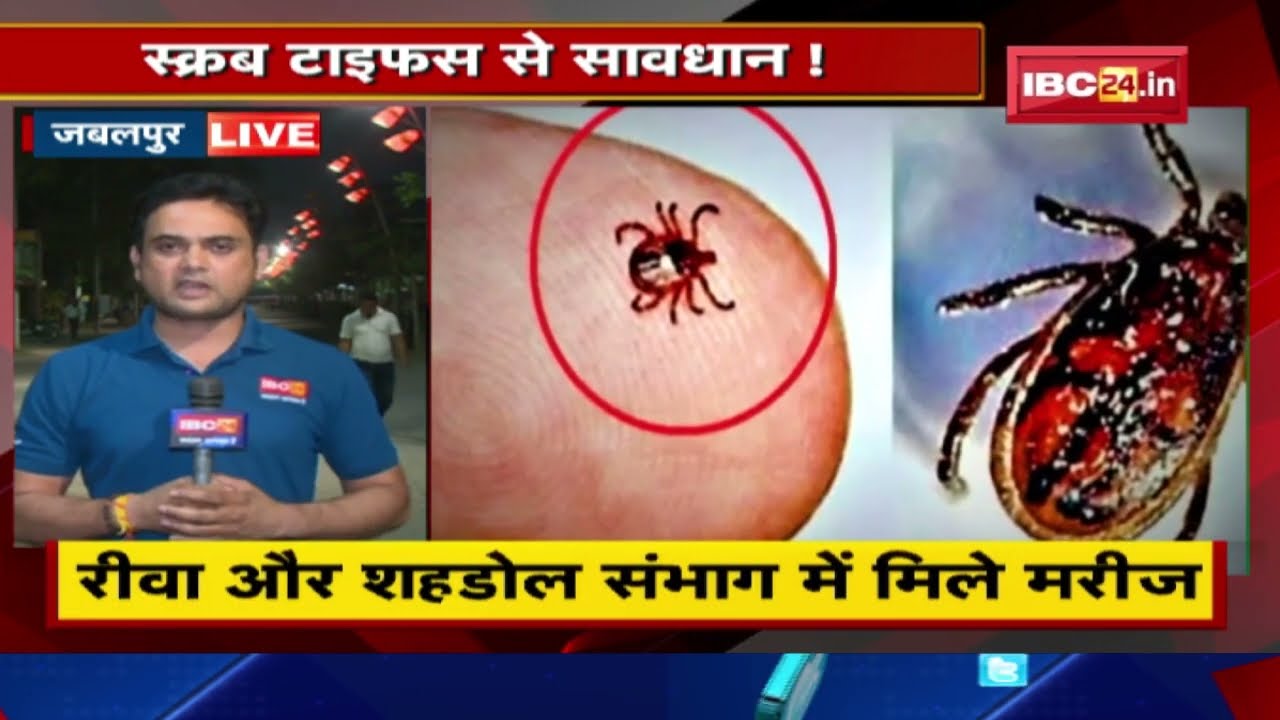 Scrub Typhus News : स्क्रब टाइफस से सावधान ! स्वास्थ्य विभाग ने जारी किया अलर्ट