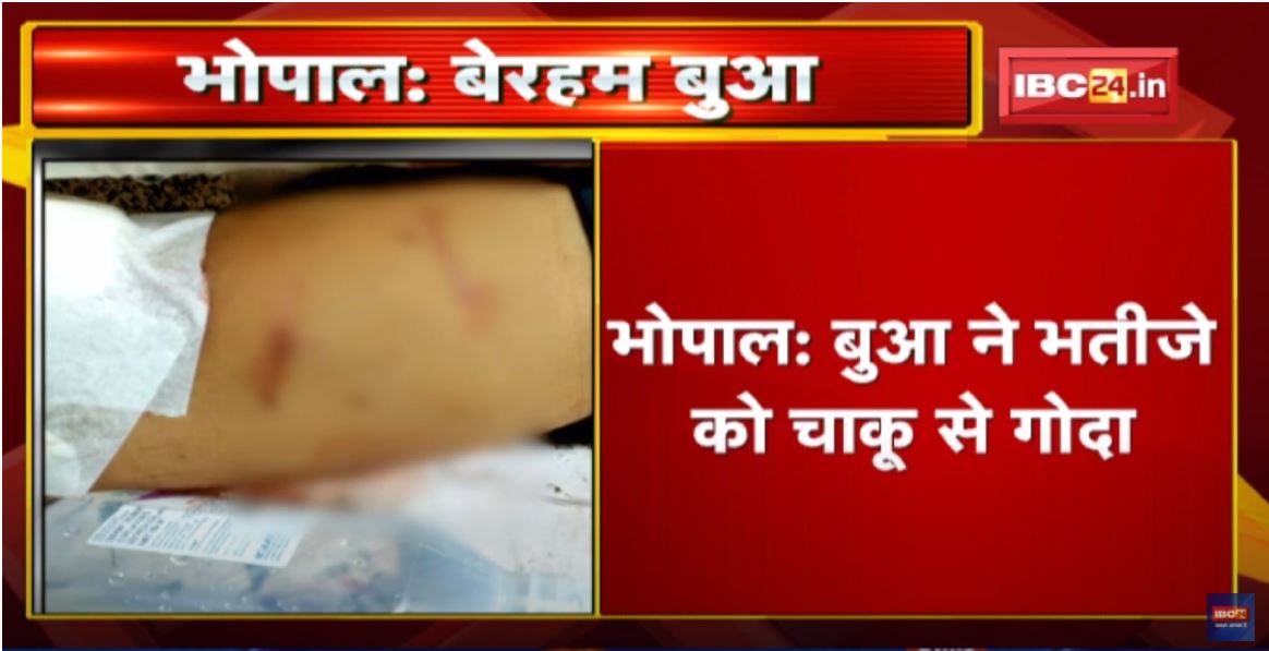 Bhopal : बुआ ने भतीजे को चाकू से गोदा | बच्चे को Bathroom में बंद कर किया हमला