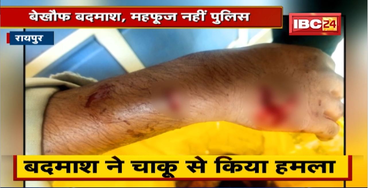 Raipur Crime News : बेखौफ बदमाश, महफूज नहीं पुलिस। गश्त पर निकले पुलिस जवान पर हमला