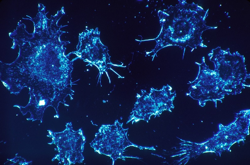 कैंसर को खत्म करने विशेषज्ञों ने ढूंढा वायरस, इंसान पर किया गया ट्रायल, सामने आया ये परिणाम