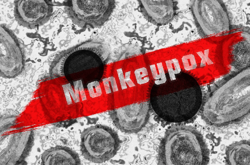 Monkeypox in Country