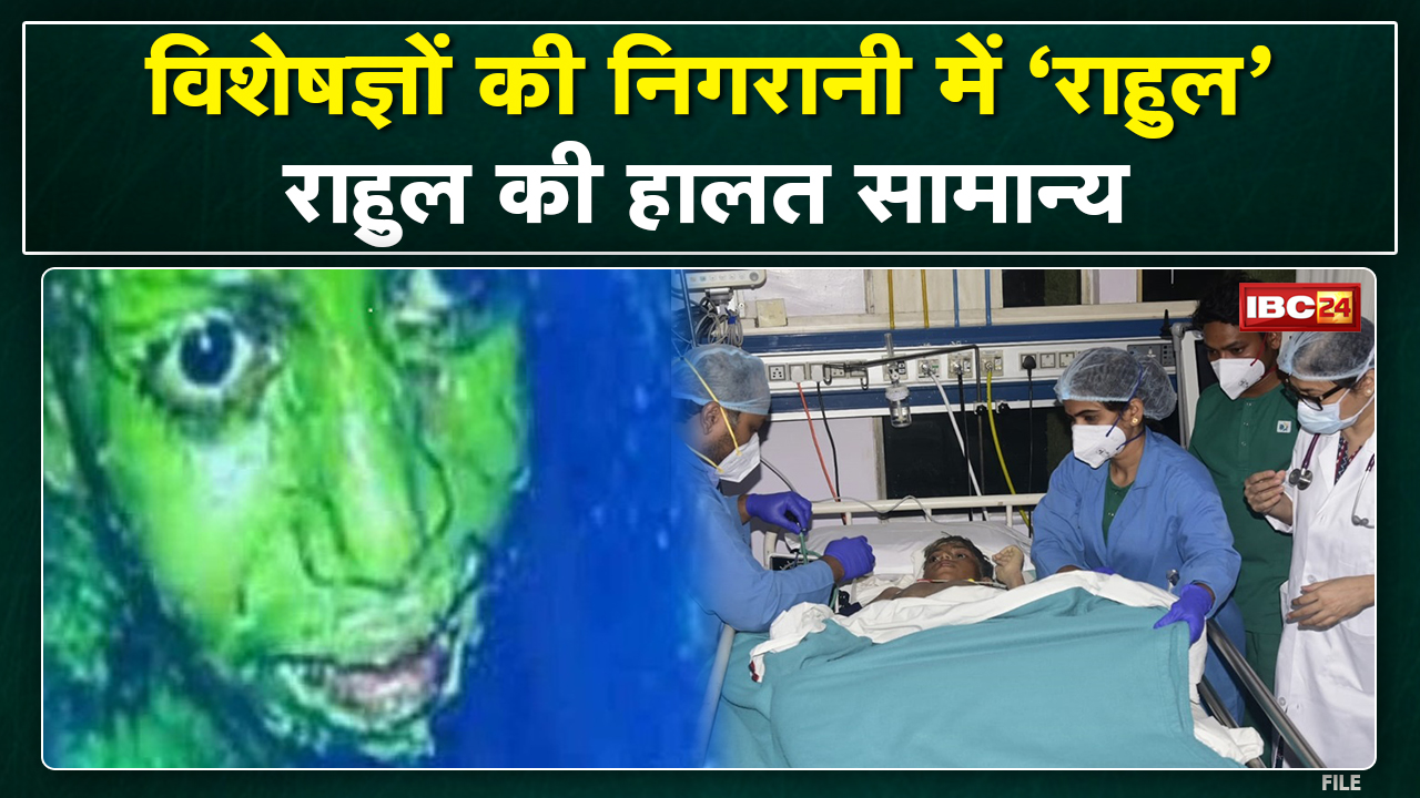 Rahul Sahu Janjgir Champa Borewell Update : राहुल साहू के स्वास्थ्य को लेकर डॉक्टर ने कही ये बात..