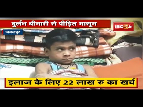 Jabalpur News : दुर्लभ बीमारी से पीड़ित मासूम | लोगों से मदद की अपील कर रहे परिजन