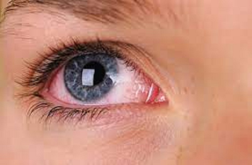 Health Signs Visible in Eyes