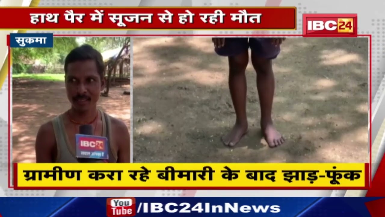 Chhattisgarh में यहां हाथ पैर में सूजन से हो रही मौत | ग्रामीण बीमारी के बाद करा रहे झाड़-फूंक…