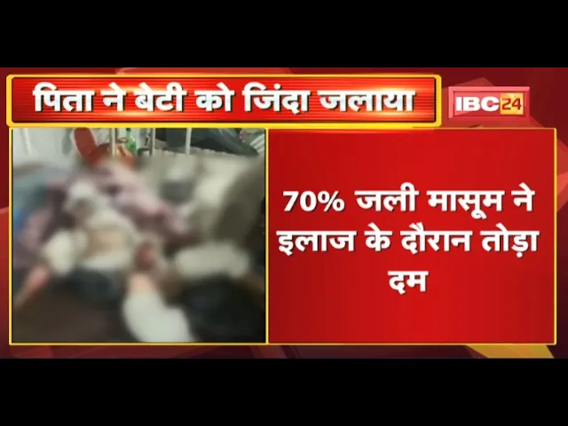 Gwalior : पिता ने बेटी को जिंदा जलाया | इलाज के दौरान मासूम बच्ची की मौत