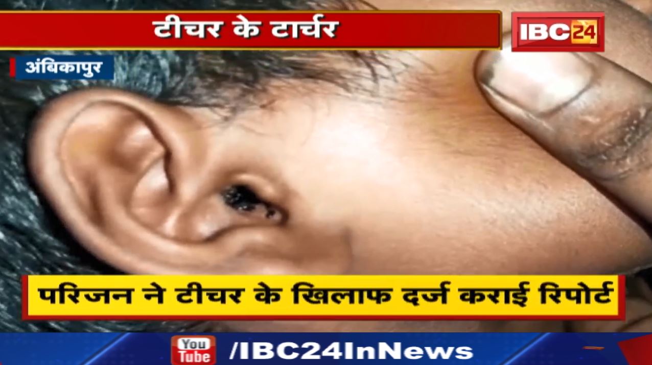 गुरु पूर्णिमा के दिन जल्लाद बनिस टीचर! छात्र के कान ले निकलिस खून…