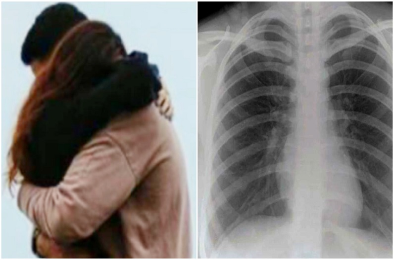 ‘जादू की झप्पी’ देते वक्त प्रेमी ने किया ऐसा कांड कि गर्लफ्रेंड ने दर्ज कर दिया केस, अब कर रही लाखों रुपए की डिमांड