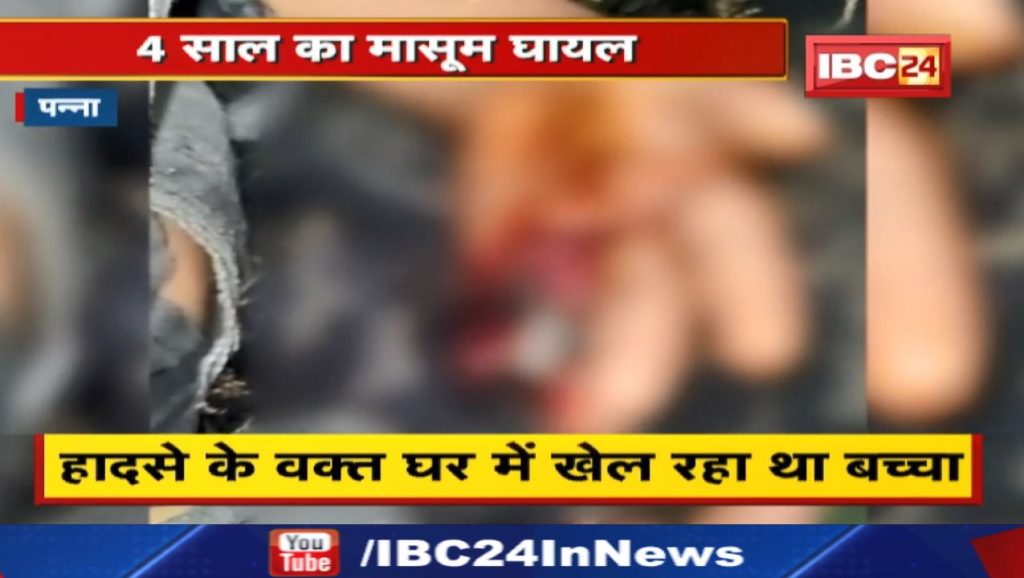 Mobile Charger Blast : Mobile Charger Blast... caught fire | The child was playing in the house at the time of the accident