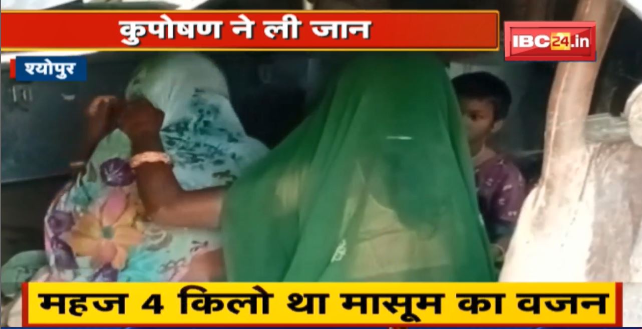 Sheopur में कुपोषण ने ली डेढ़ साल के मासूम की जान | उठे कई सवाल.. CMHO ने दी सफाई