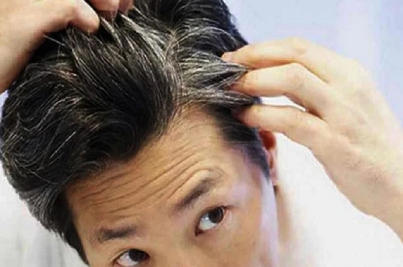 White Hair Solution: कम उम्र में ही पक गए हैं बाल तो करें ये घरेलू उपाय, महज 15 दिनों में ही दिखने लगेंगे नतीजे!