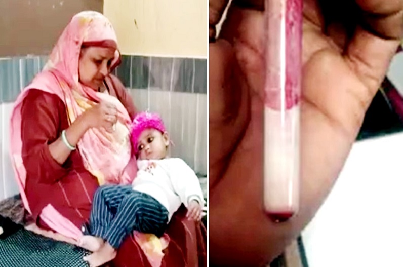 लाल की जगह सफेद निकला डेढ़ साल की मासूम का खून, डॉक्टर्स भी रह गए हैरान, जांच के लिए लंदन भेजा गया सैंपल