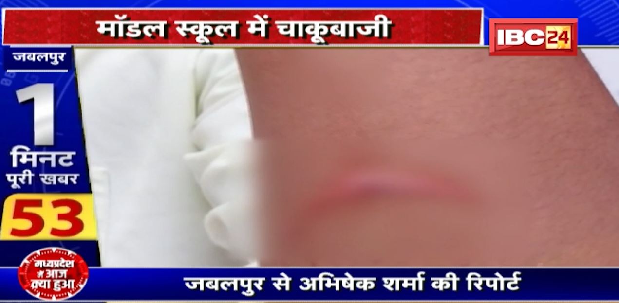 Crime in Model School of Jabalpur : मॉडल स्कूल में चाकूबाजी। छात्रों के दो गुटों के बीच चले चाकू