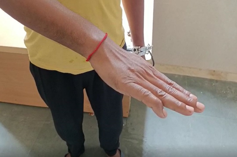 जेल में बंद कैदी का प्रहरियों ने तोड़ा हाथ, पैसे नहीं देने पर मारपीट के आरोप