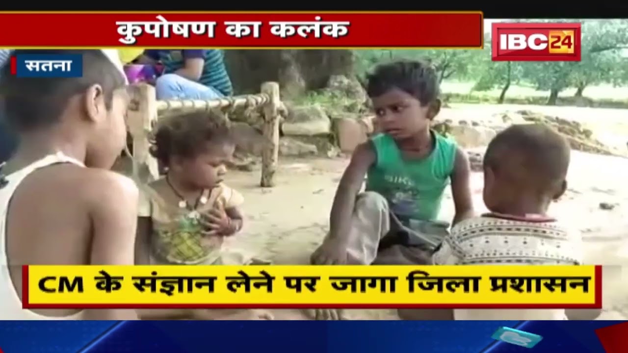 Video Viral of Satna's malnourished girl child. Officers wake up due to CM's intervention, girl admitted to hospital