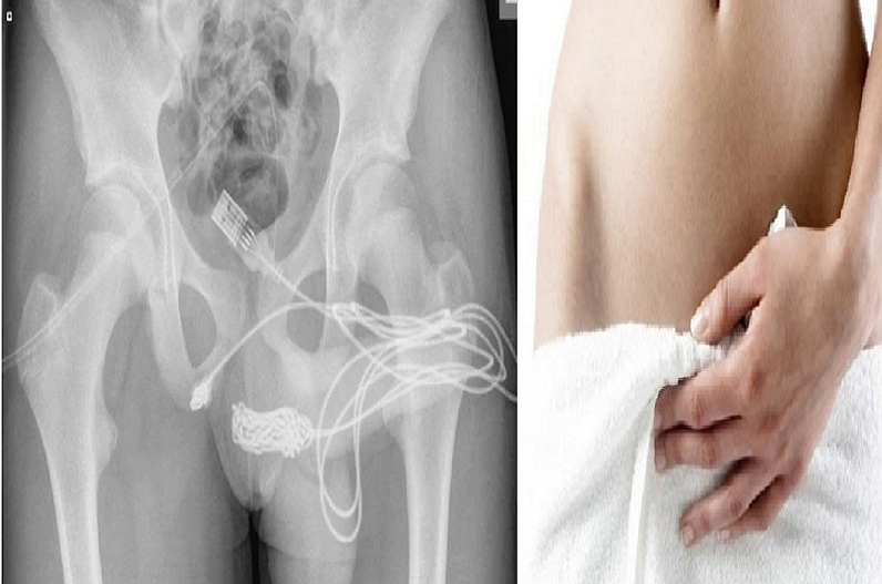 जवानी की दहलीज पर चढ़ते ही इस लड़के को आने लगा पीरियड!, वजह जानकर डॉक्टर भी हैरान