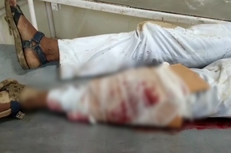 ऐसे हैं ‘धरती के भगवान’, सड़क हादसे में टूट गया पैर तो कागज का गत्ता बांधकर बोले- जाओ जिला अस्पताल में ईलाज करवाना