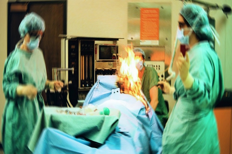 सर्जरी के दौरान महिला ने कर दी शर्मनाक हरकत, ऑपरेशन के दौरान ही लग गई आग