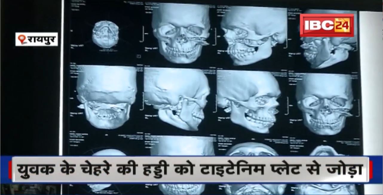 Horizon Hospital में Doctors ने किया सफल ऑपरेशन। तलवार से हुए हमले में गंभीर रुप से जख्मी युवकी की जान बचाई