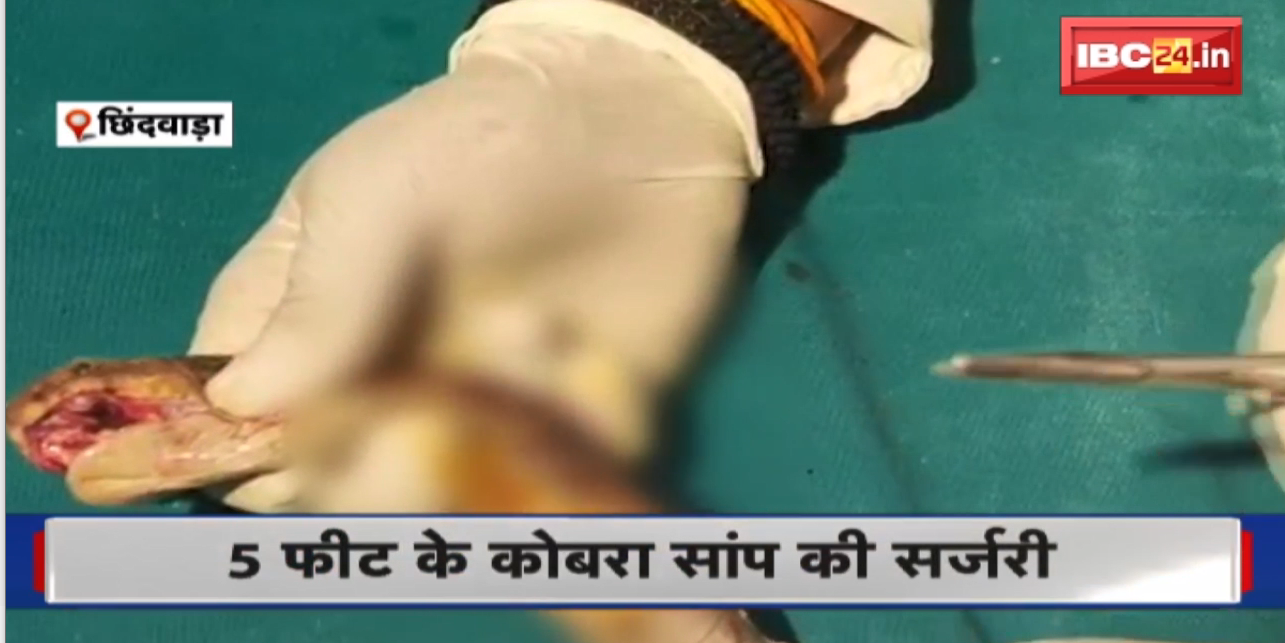 Cobra Snake Surgery Video : 5 फीट के कोबरा सांप की करीब 45 मिनट तक चली सर्जरी | सांप को 3 दिन तक देखरेख में रखा गया
