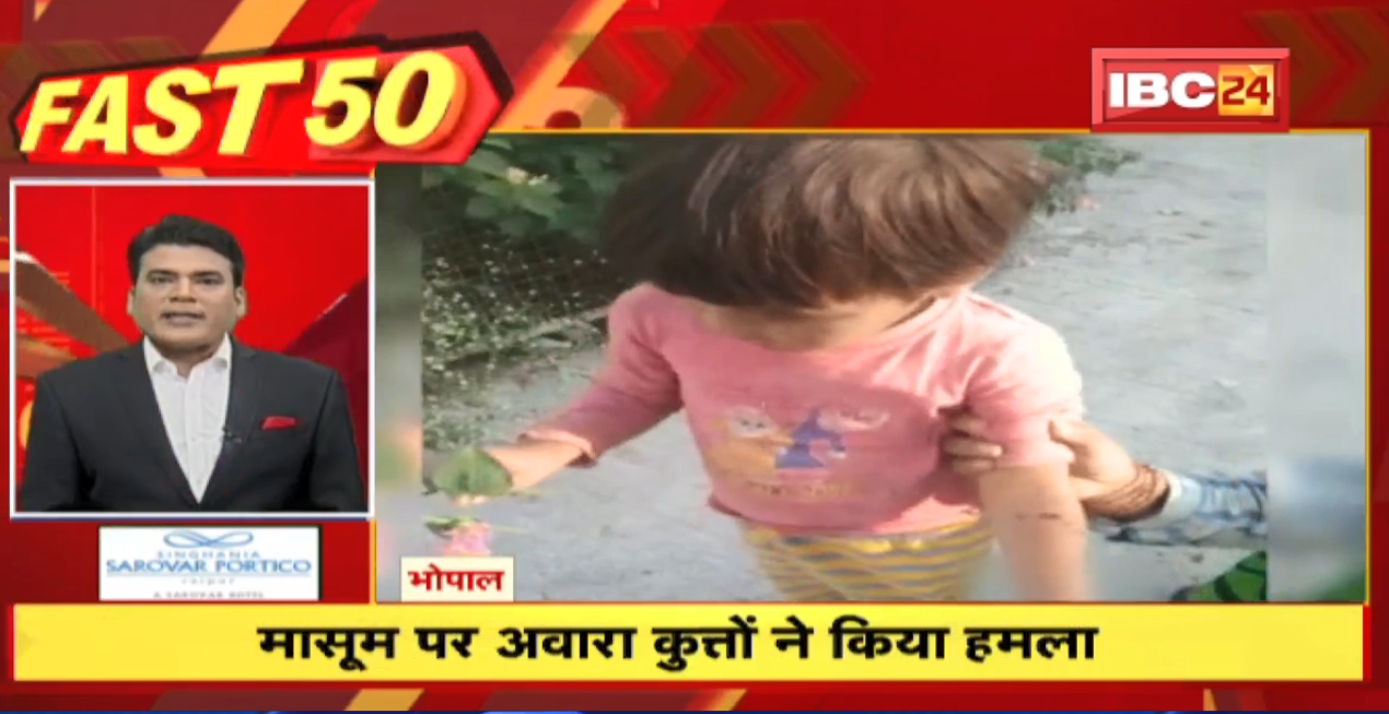 मासूम पर आवारा कुत्तों ने किया हमला। Fast 50 | Watch The Latest Top50 News Of The Day