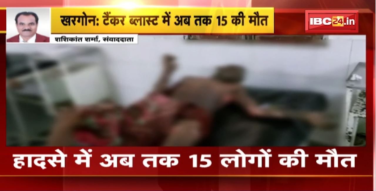 Khargone Petrol Tanker Blast Case : टैंकर ब्लास्ट में अब तक 15 की मौत। इलाज के दौरान 2 और लोगों ने की मौत
