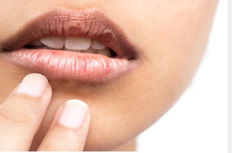 How to get rid of dry lips: सर्दी शुरु होते ही ड्राई होने लगे हैं आपके भी होठ…? करें ये आसान उपाय