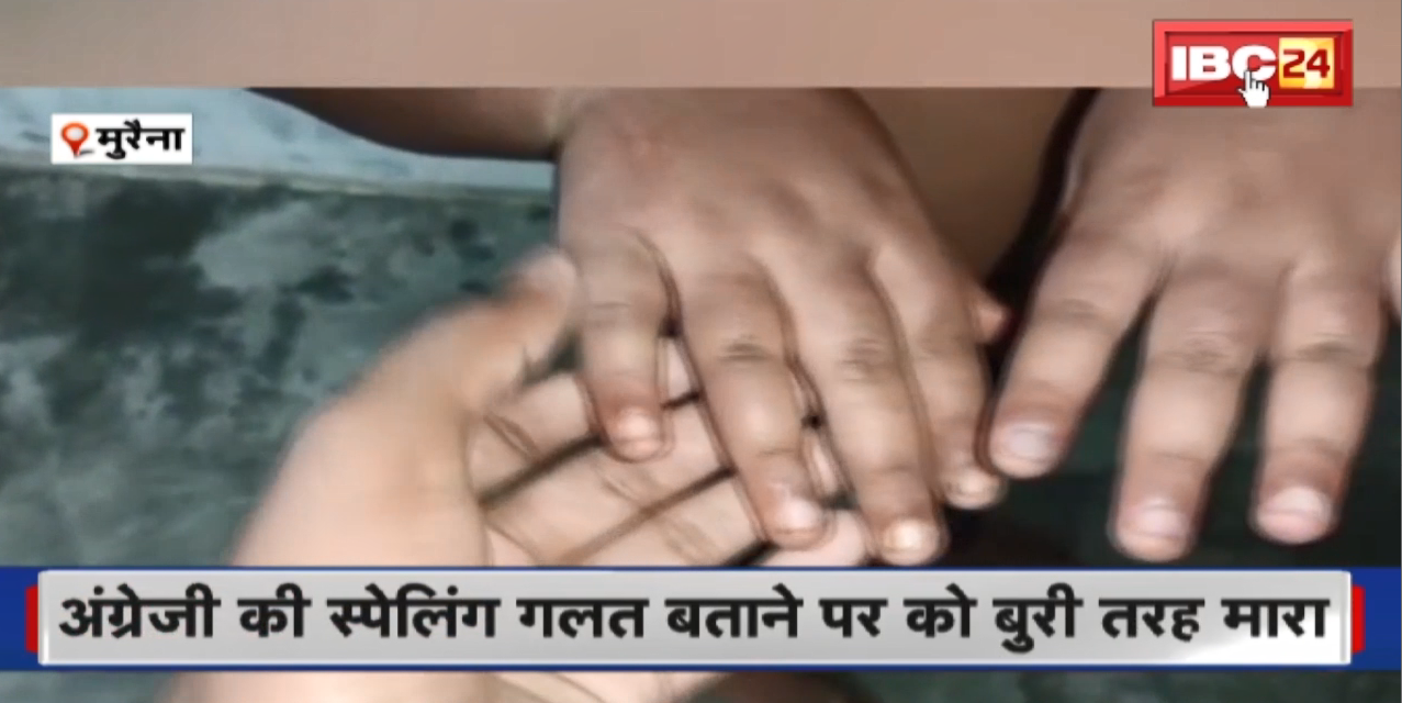 अंग्रेजी की Spelling गलत बताने पर छात्र को शिक्षक ने बुरी तरह मारा। शिक्षक पर केस दर्ज, तलाश में जुटी Police