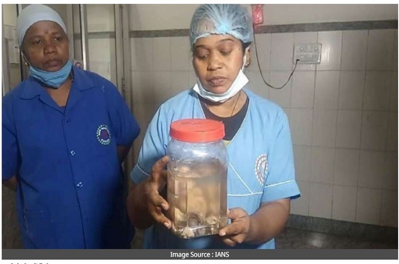 OMG!  21 दिन की बच्ची के पेट में मिले आठ भ्रूण, डॉक्टर हैरान, बोले- दुनिया का पहला केस