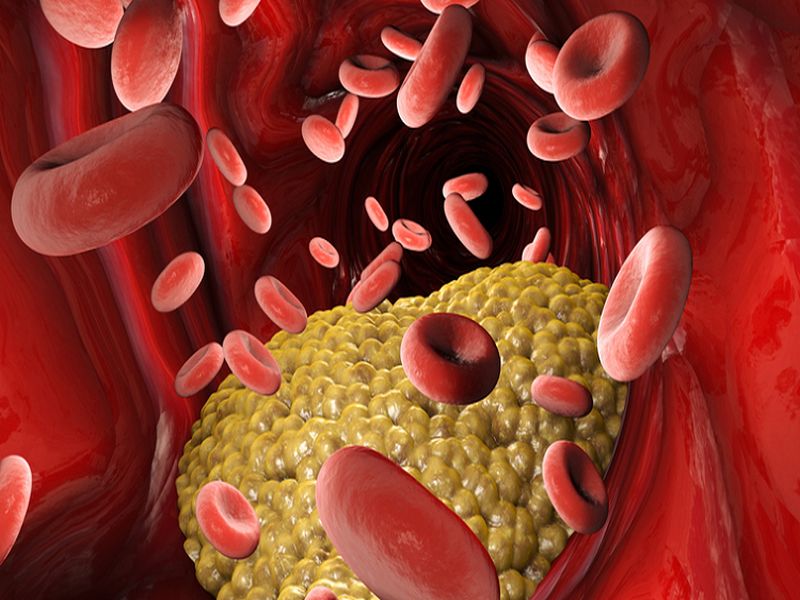 How To Reduce bad Cholesterol Fast