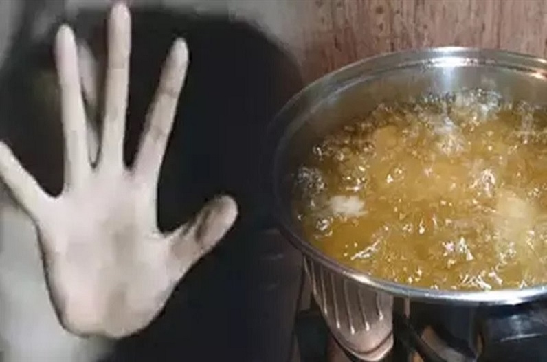 Wife Spills Boiling Oil on Husband