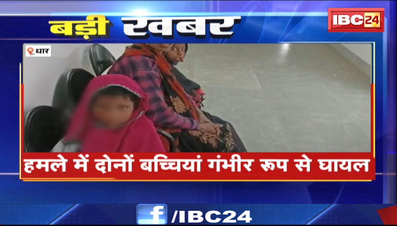 धार में आवारा कुत्तों का आतंक। 2 बच्चों पर स्ट्रीट डॉग ने किया हमला