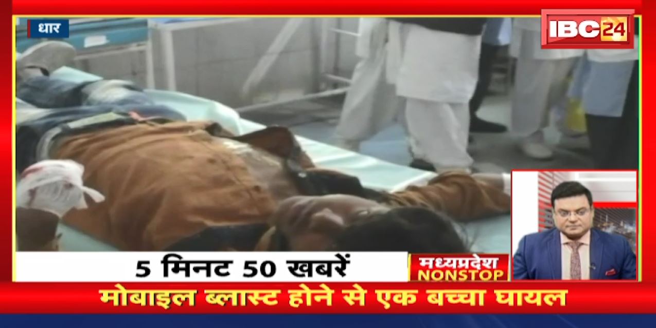Mobile Blast होने से एक बच्चा घायल। Madhya Pradesh Non Stop News । Today Top News