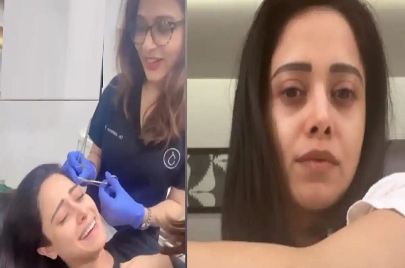 शूटिंग के दौरान घायल हुई एक्ट्रेस, चेहरे और हाथ पर लगे टांके, खुद शेयर किया VIDEO