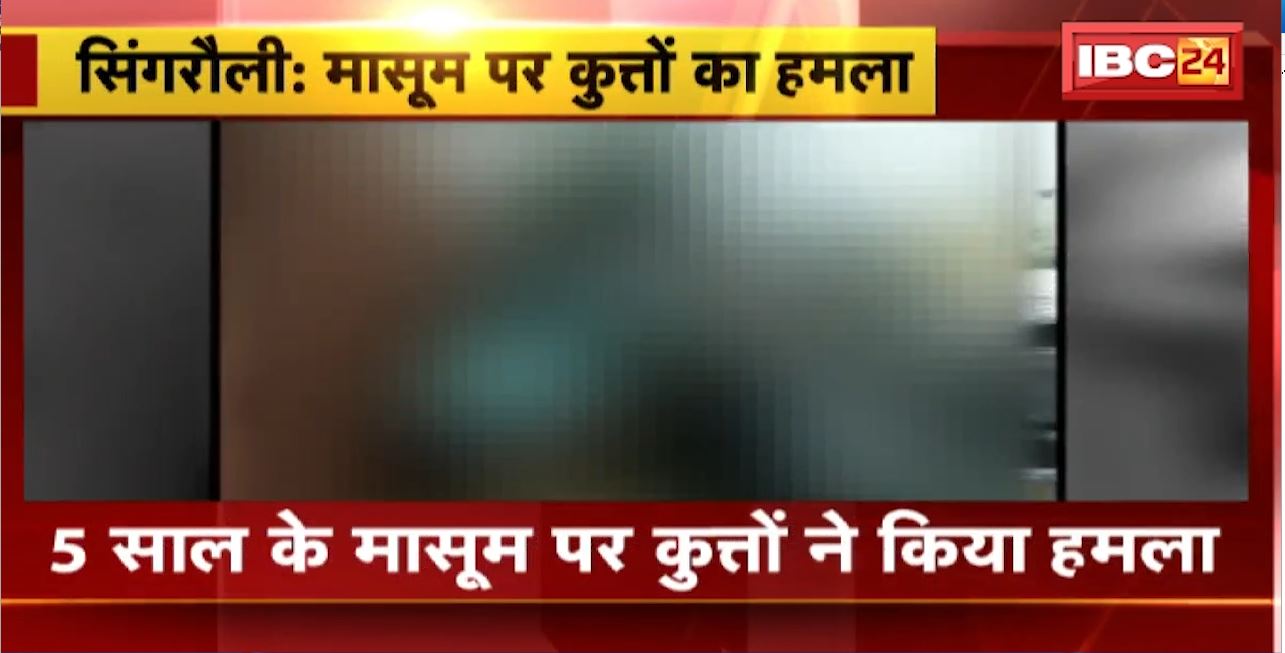 Singrauli Dog Attack : 5 साल के मासूम पर कुत्तों ने किया हमला। मासूम गंभीर रुप से घायल